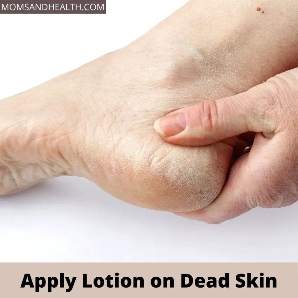 Apply Lotion on Dead Skin | Layers of Skin